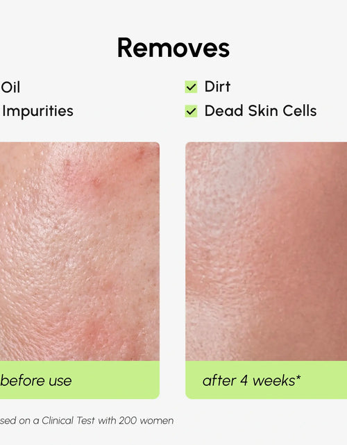 Load image into Gallery viewer, Daily Glow Exfoliating Toner
