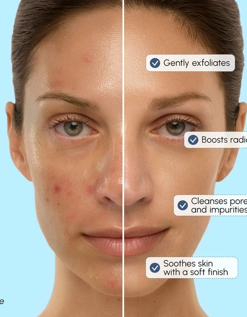 Load image into Gallery viewer, Face Polishing Scrub &amp; Exfoliator
