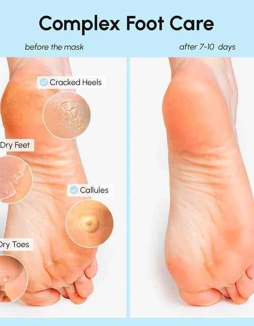 Load image into Gallery viewer, Exfoliating &amp; Hydrating Foot Mask
