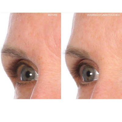 Load image into Gallery viewer, SiO Beauty Brow Lift Face Mask 1ct - New

