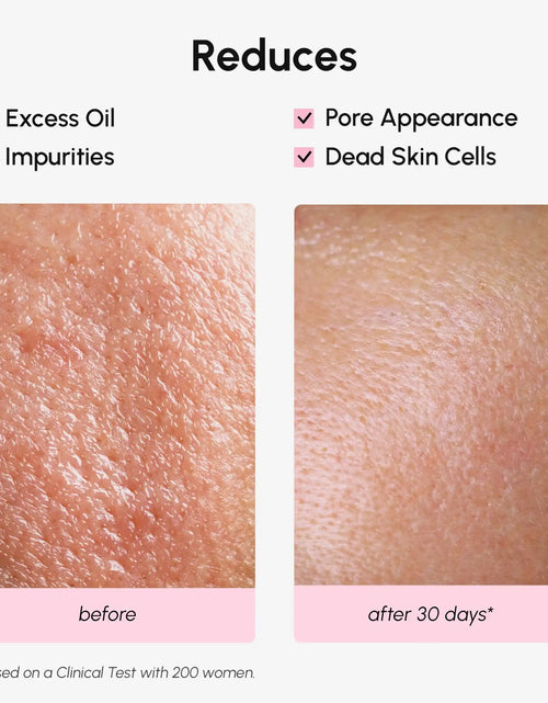 Load image into Gallery viewer, Hydrating Pore Refining Toner
