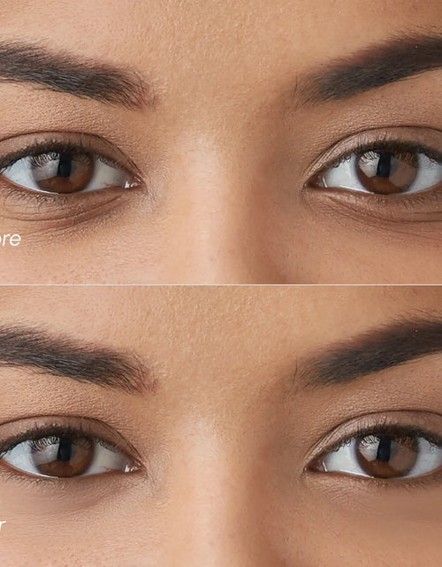 Load image into Gallery viewer, Violet Eye Patches for Dark Circles
