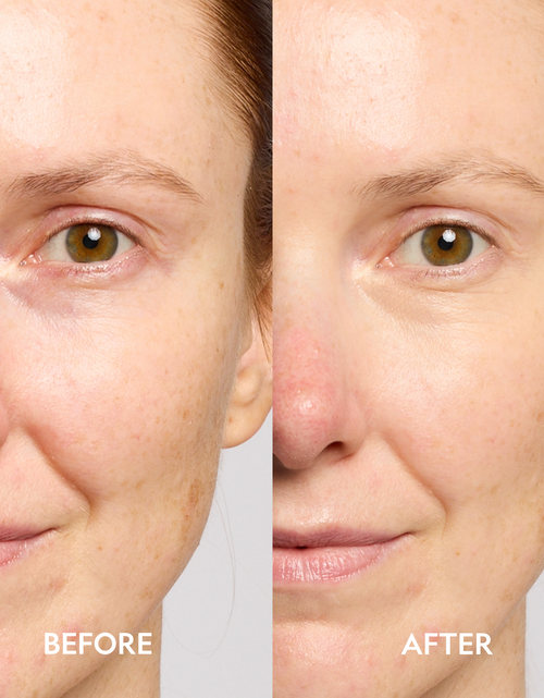 Load image into Gallery viewer, Super Bright Dark Circle Serum Peptide Corrector
